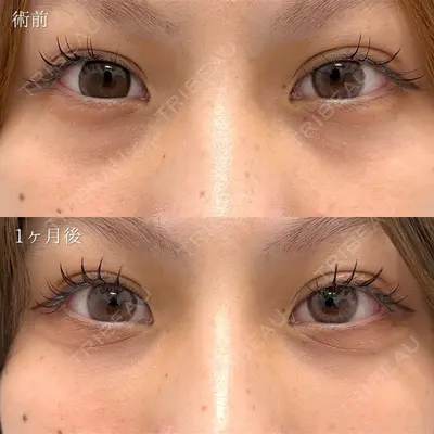 TCB東京中央美容外科 浜松院の症例