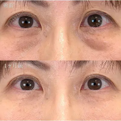 TCB東京中央美容外科 浜松院の症例