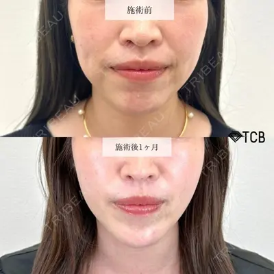 TCB東京中央美容外科 宇都宮院 富田 秀鷹医師の症例