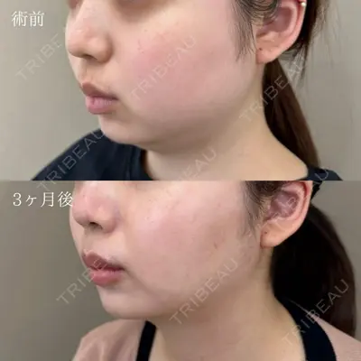 TCB東京中央美容外科 高崎院の症例