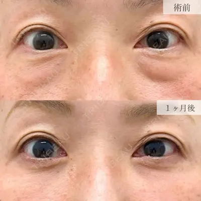 TCB東京中央美容外科 浜松院の症例