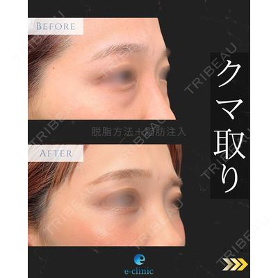 eクリニック 新宿院 相原 隆充医師の症例