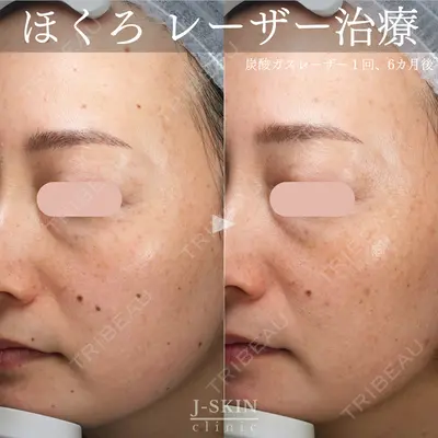 Jスキンクリニック 【J-SKIN clinic】の症例