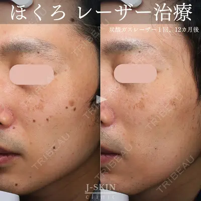 Jスキンクリニック 【J-SKIN clinic】の症例