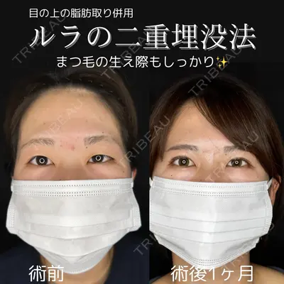 ルラ美容クリニック 仙台院 / ルラスキンクリニック 仙台院 橋本 英樹医師の症例