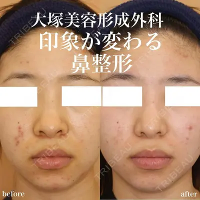 大塚美容形成外科 金沢院の症例