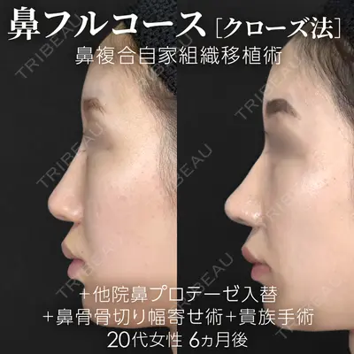ジョウクリニック 銀座院 重本　譲医師の症例