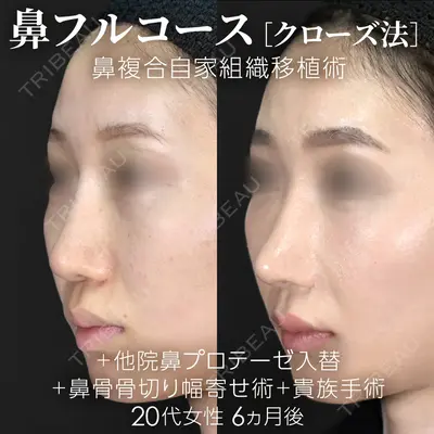 ジョウクリニック 銀座院 重本　譲医師の症例