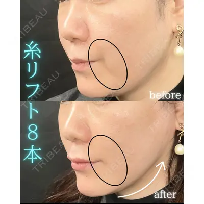 THE FIRST CLINIC 町田院の症例