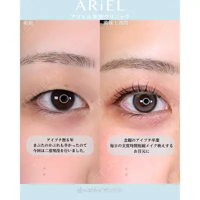 アリエル美容クリニック 横浜院 渡邉 光医師の症例