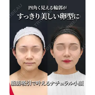 湘南美容クリニック 秋葉原院 名倉 俊輔医師の症例