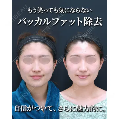 湘南美容クリニック 秋葉原院 名倉 俊輔医師の症例