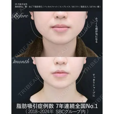 湘南美容クリニック 秋葉原院 名倉 俊輔医師の症例