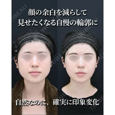 湘南美容クリニック 秋葉原院 名倉 俊輔医師の症例