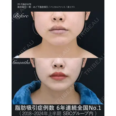 湘南美容クリニック 秋葉原院 名倉 俊輔医師の症例