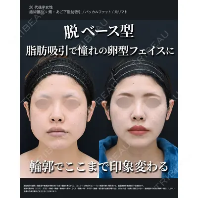 湘南美容クリニック 秋葉原院 名倉 俊輔医師の症例