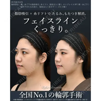 湘南美容クリニック 秋葉原院 名倉 俊輔医師の症例
