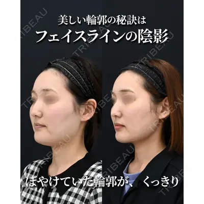 湘南美容クリニック 秋葉原院 名倉 俊輔医師の症例