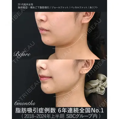 湘南美容クリニック 秋葉原院 名倉 俊輔医師の症例