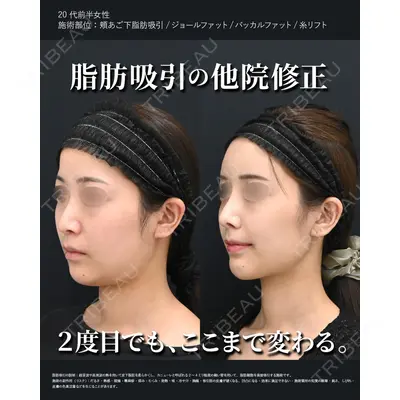 湘南美容クリニック 秋葉原院 名倉 俊輔医師の症例