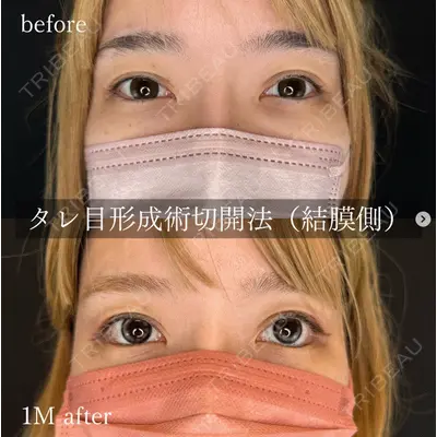 ルラ美容クリニック 大阪心斎橋院の症例