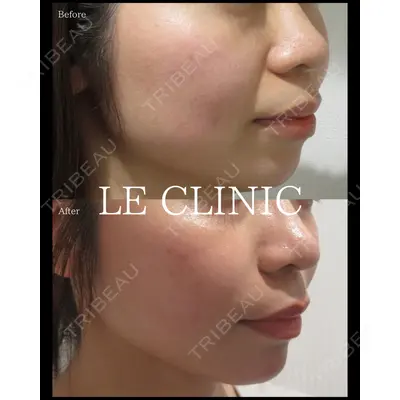 LE CLINICの症例