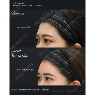 湘南美容クリニック 秋葉原院 名倉 俊輔医師の症例