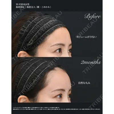 湘南美容クリニック 秋葉原院 名倉 俊輔医師の症例