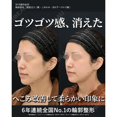 湘南美容クリニック 秋葉原院 名倉 俊輔医師の症例