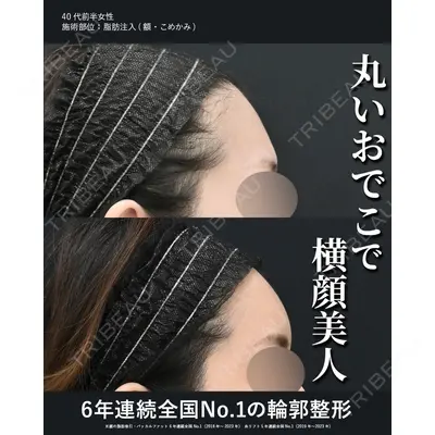 湘南美容クリニック 秋葉原院 名倉 俊輔医師の症例