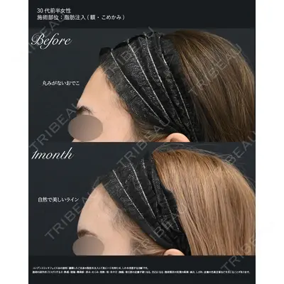 湘南美容クリニック 秋葉原院 名倉 俊輔医師の症例