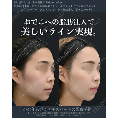 湘南美容クリニック 秋葉原院 名倉 俊輔医師の症例