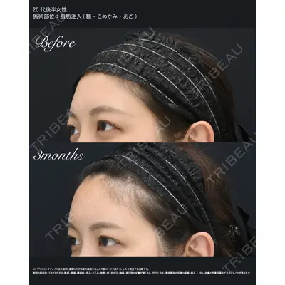 湘南美容クリニック 秋葉原院 名倉 俊輔医師の症例