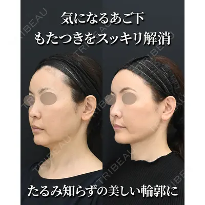 湘南美容クリニック 秋葉原院 名倉 俊輔医師の症例