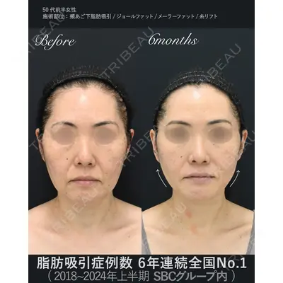 湘南美容クリニック 秋葉原院 名倉 俊輔医師の症例
