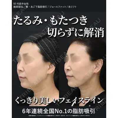 湘南美容クリニック 秋葉原院 名倉 俊輔医師の症例