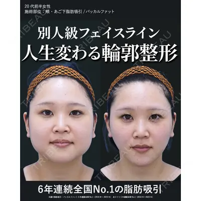 湘南美容クリニック 秋葉原院の症例
