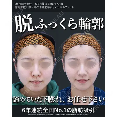 湘南美容クリニック 秋葉原院 名倉 俊輔医師の症例