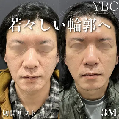 YBC横浜美容外科 立川院 大島 諒士医師の症例