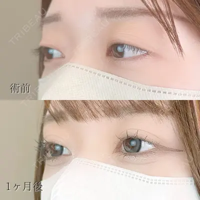 TCB東京中央美容外科 高知院の症例