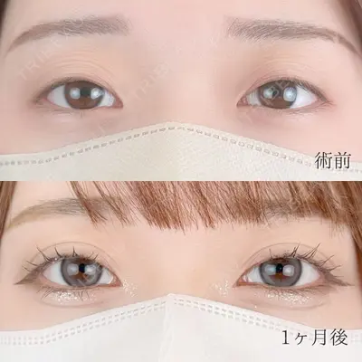 TCB東京中央美容外科 高知院の症例