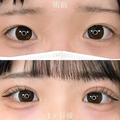 TCB東京中央美容外科 三島院の症例