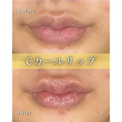 ルラ美容クリニック 京都院の症例