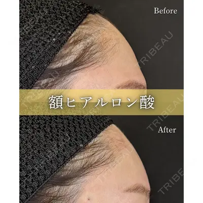 ルラ美容クリニック 京都院の症例
