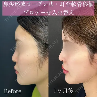 ルラ美容クリニック 渋谷本院 昼間 路子医師の症例