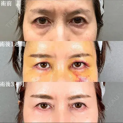 アリエル美容クリニック 大宮院 鈴木　桂介医師の症例