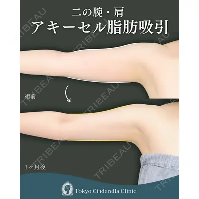 東京シンデレラ美容外科  横浜院 吉田 利之医師の症例