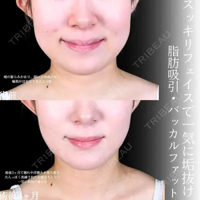 アリエル美容クリニック 大宮院 江郷隼一郎医師の症例