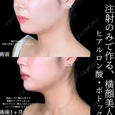アリエル美容クリニック 水戸院 天白 典秀医師の症例