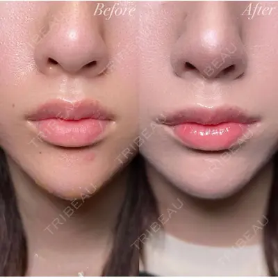 R Beauty CLINIC 大阪院 小池 泰弘医師の症例